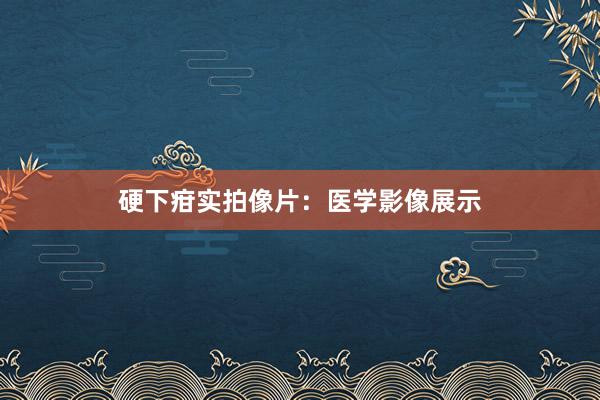 硬下疳实拍像片：医学影像展示